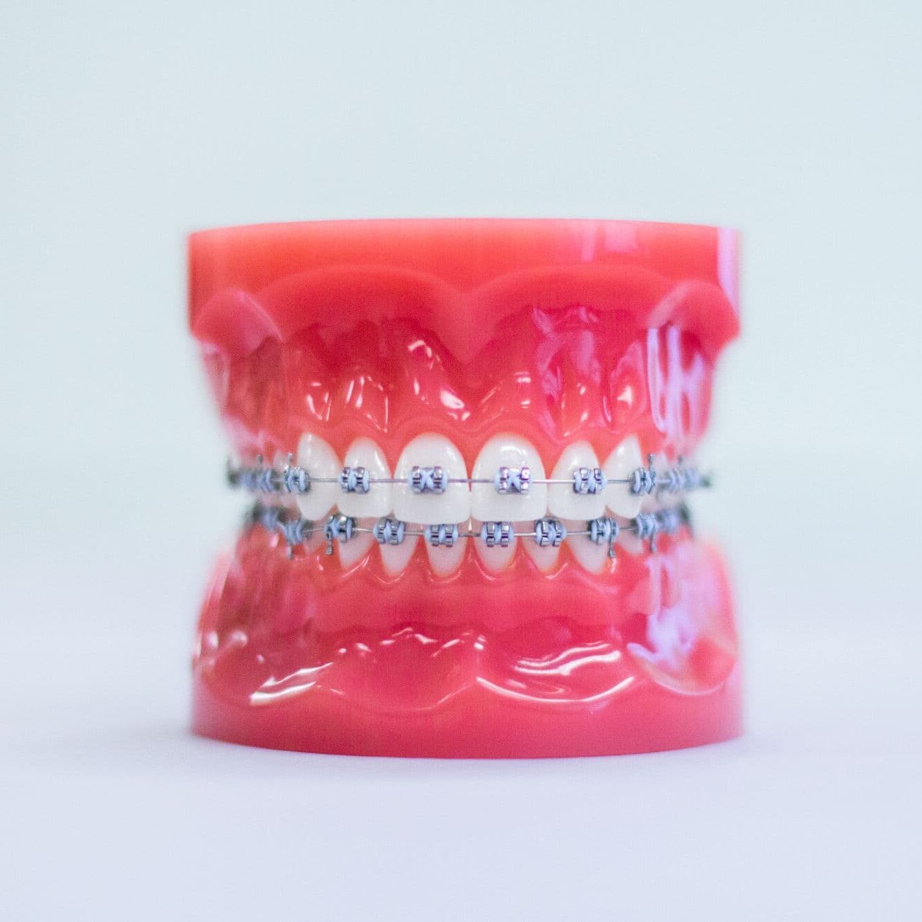 Metal Braces Beaverton